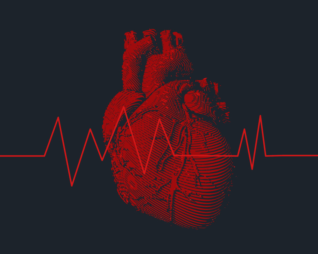 Can Arrhythmia Be Inherited