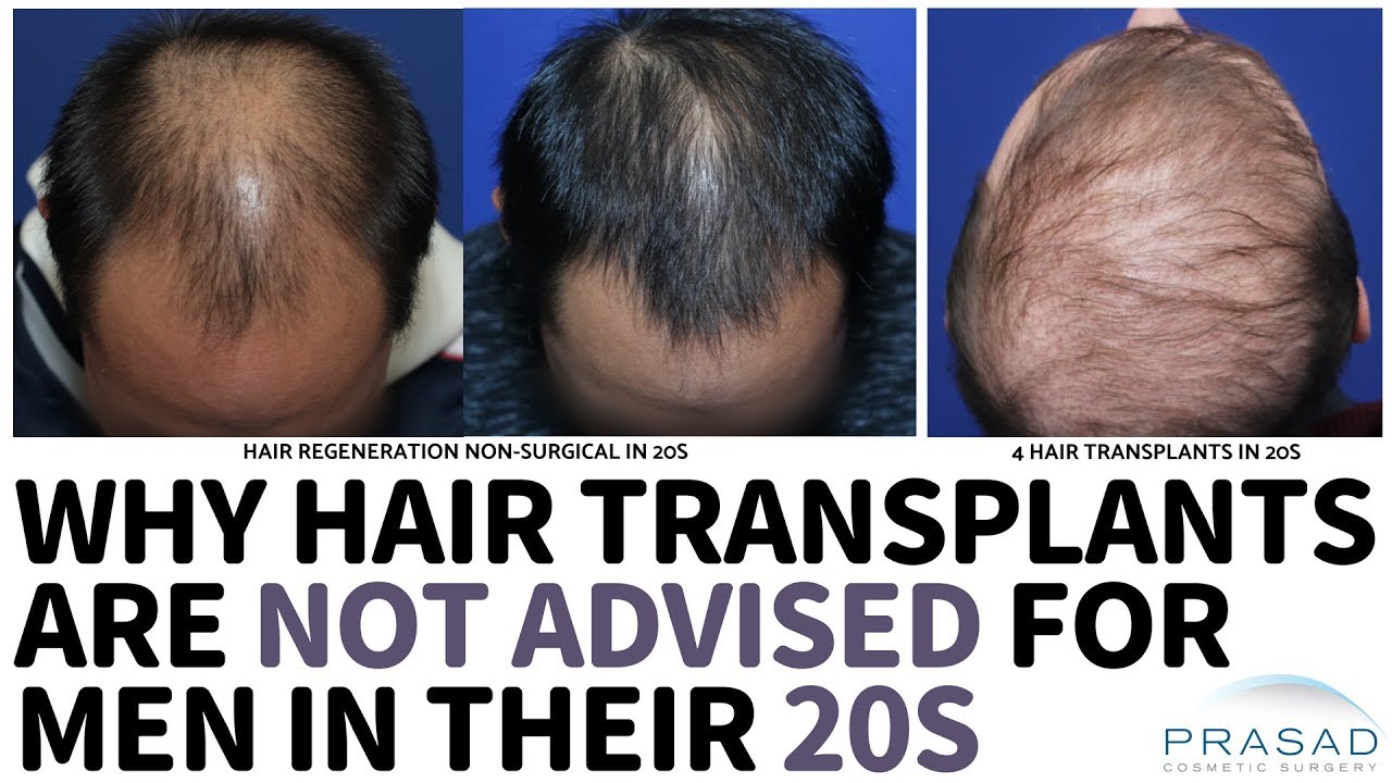 Why Hair Transplants are Not Advised for Men in their 20s | Anaaya Foods