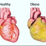 signs of unhealthy heart