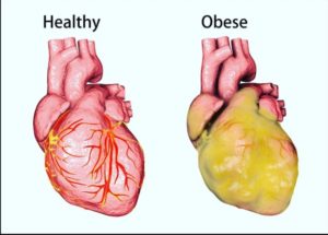 signs of unhealthy heart
