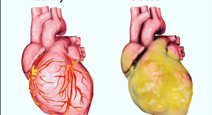 signs of unhealthy heart